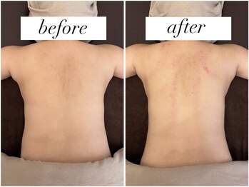 フウ(fuu.)/上半身かっさほぐし