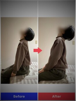 ぷめはな整体/before/After