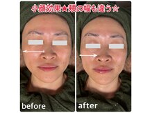 トータルビューティー雅の雰囲気（フェイスラインが変わる引き締まった小顔へ）