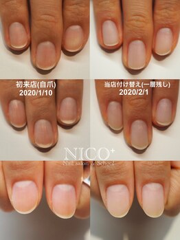 ニコプラス(NICO+)/パラジェルクリア補強