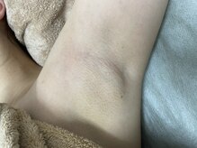 ナノハナ/鹿沼市全身脱毛美容室ナノハナ