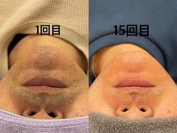 ふぁみーゆ(famille)/毎朝のヒゲ剃りが楽に♪