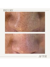 アンド(&.)/before/after