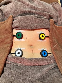 仁接骨院 じん鍼灸治療院の写真/【熟練の鍼灸師による本格施術】身体だけでなく頭や顔の鍼灸施術で全身疲労回復！お悩みを根本から改善★