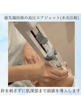 グロワール(gloire)/【再生美容】施術風景