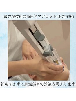 グロワール(gloire)/【再生美容】施術風景