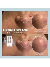 フルアナ(Hu ruana)/フェイシャルエステ