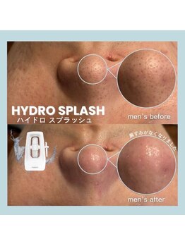 フルアナ(Hu ruana)/フェイシャルエステ