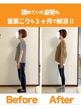 整体院ひなた 都城院/諦めていた首肩こり猫背改善!!