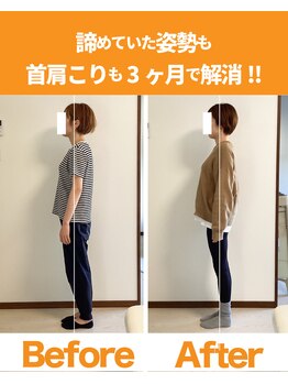 整体院ひなた 都城院/諦めていた首肩こり猫背改善!!