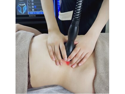 フェイス(TwinQle)の写真