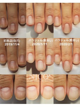 ニコプラス(NICO+)/パラジェルクリア補強