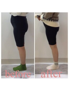 スタイルラボ高松/産後骨盤矯正の効果♪