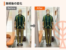 ただき接骨院 整体院 高崎本院/施術後の変化：首肩こり・腰痛