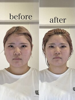 エメ 倉敷店(Aimer)/骨格補正ヘッドスパ 小顔矯正