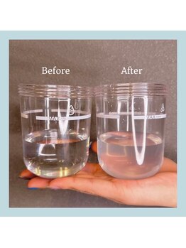 フルアナ(Hu ruana)/フェイシャルエステ