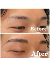 アンク(AnnC)/ハリウッドブロウリフト