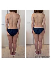 ハートエルボー(Heart elbow)/アフターの写真の方が体重多い