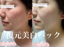 ベリンダ(belinda)/【復元パック】一発美白で衝撃！