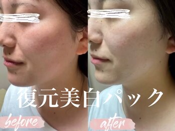 ベリンダ(belinda)/【復元パック】一発美白で衝撃！