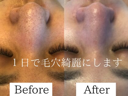 ルアナアイナ 久屋大通の写真