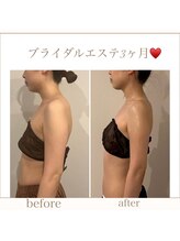 マージェ(magie)/ブライダルエステ