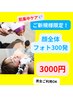 【美肌フォト】顔全体300発照射【ニキビケア・リフトアップ】【男女OK】