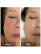 サロン ド アヤ(salon de Aya)/エイジング+保湿ケア