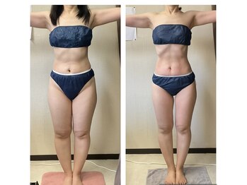 ビボディラボ 海老名店(美Body Labo)/40代★Before→After