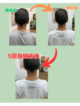 楽する鍼灸 整骨院 南福岡院/