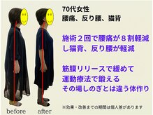 とりまる整体院 アイワイ(iy)/70代女性の腰痛、猫背、反り腰に