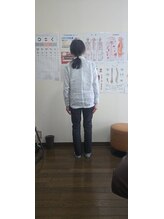 整体院晴々 清水院/【before】