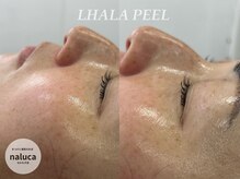 ナルカ(naluca)/【堺市・北花田】ララピール