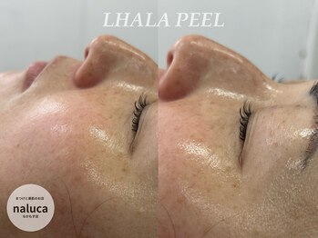 ナルカ(naluca)/【堺市・北花田】ララピール