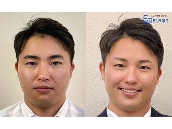 ファースト 新宿本店/自然/平行/アーチ/角眉/新宿