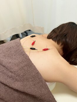 まごころ整骨院/鍼施術