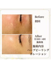 リラキュート(Rela Cute)/月1回フェイシャルでこの変化