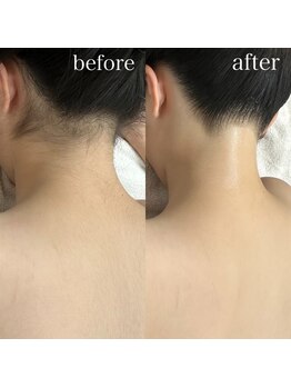 アンドエス(&S.)/うなじ美人日々誕生しています♪