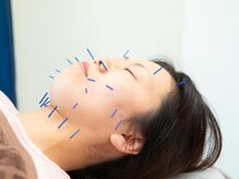 かたえ鍼灸整体院