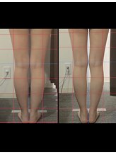 ビタミンスパ 中野店/－3.6ｃｍダウン★施術回数5回