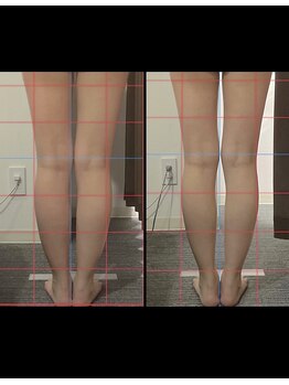 ビタミンスパ 中野店/-3.6cmダウン★施術回数5回