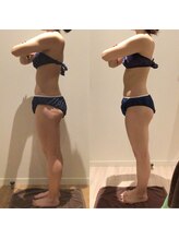 アユアランリンク 札幌店/20代後半/約3ヵ月/-4.1kg/側面