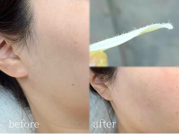 ユーアイ(Yu_eye)/フェイスWax