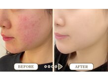 ビシルク(美 Silk)/赤ら顔/静岡/草薙/清水区]