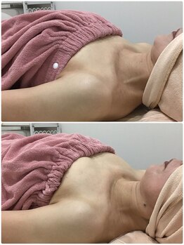 ビューティーサロン シンデレラ 心斎橋本店(Cinderella)/バストケア　60代のお客様