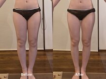 常若(tokowaka)/高周波ケア1回/ビフォーアフター