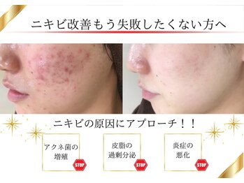 エピア 半田店(Epia)