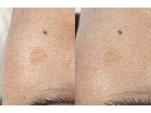 ミリアージュ(Miliage)