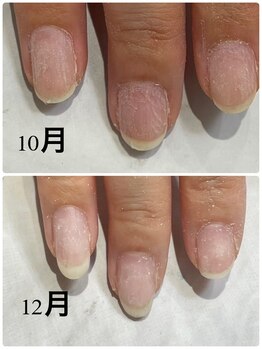 グレースレディ 神戸北店/