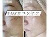 【感動の肌質改善♪くすみシミたるみケア/毛穴に】VOSサロンエイジングケア